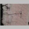Neuronas Golgi 16.jpg